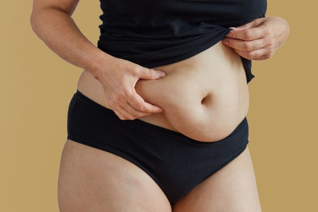 Tummy Tuck Help with Weight Loss