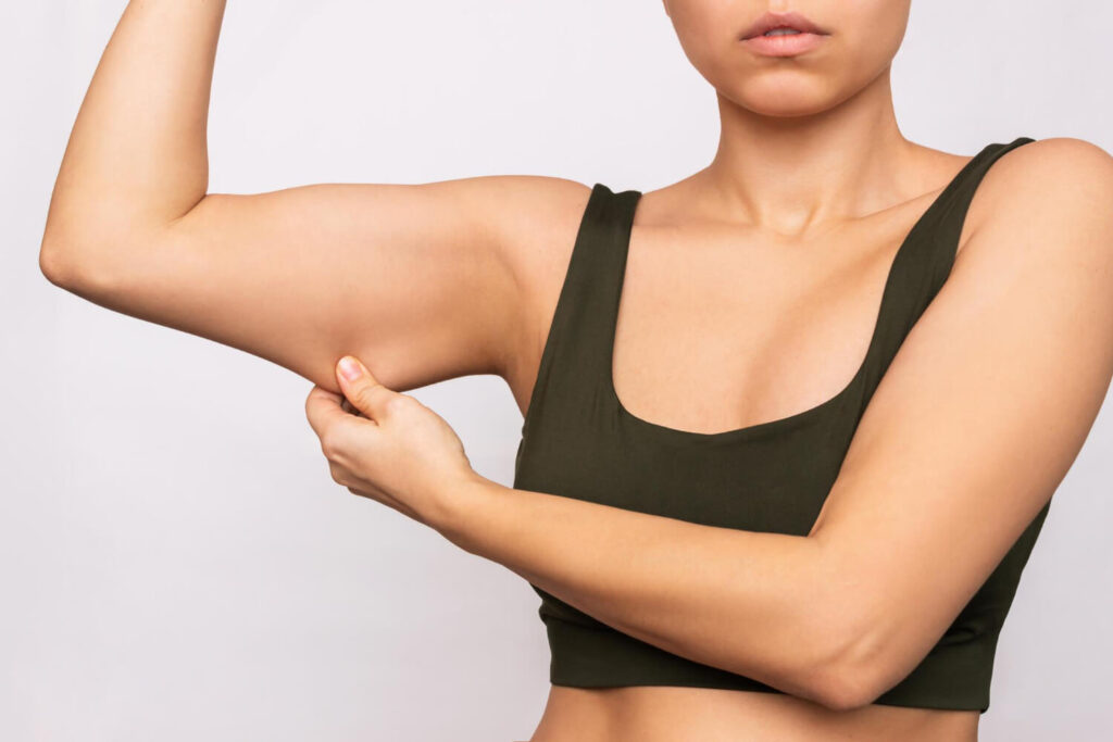 Arm Liposuction vs Brachioplasty