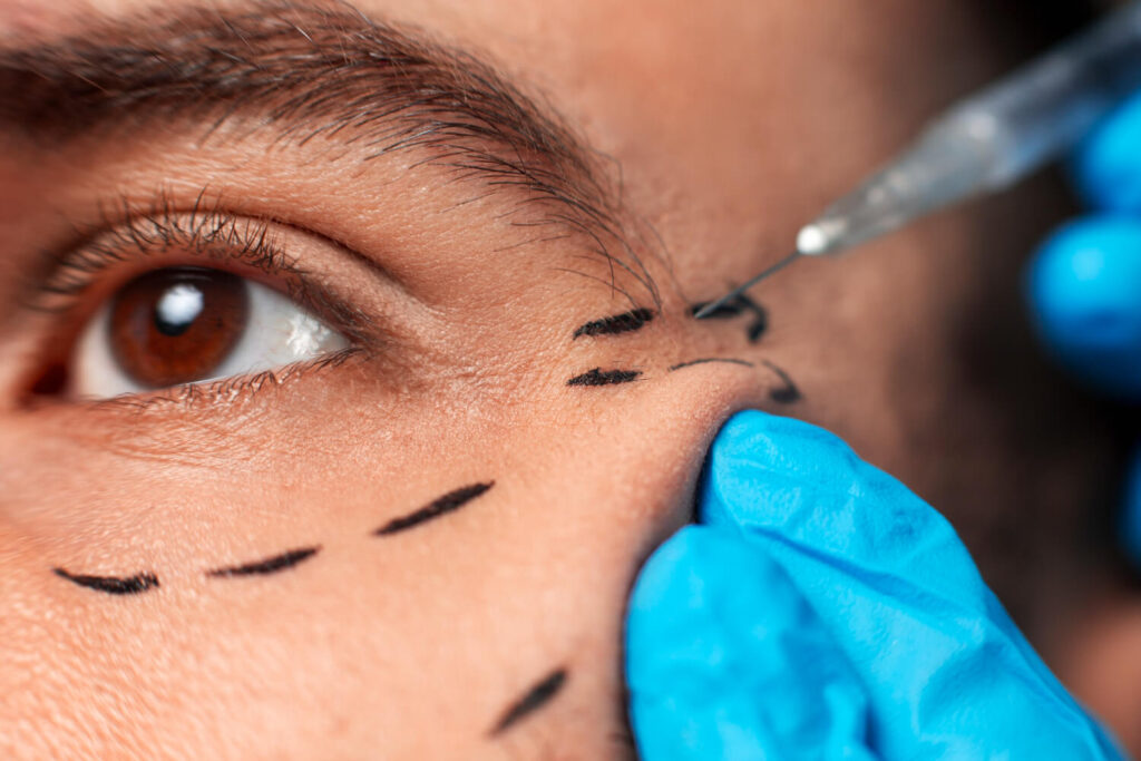 blepharoplasty cost