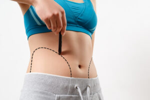 dangers of undergoing lipo