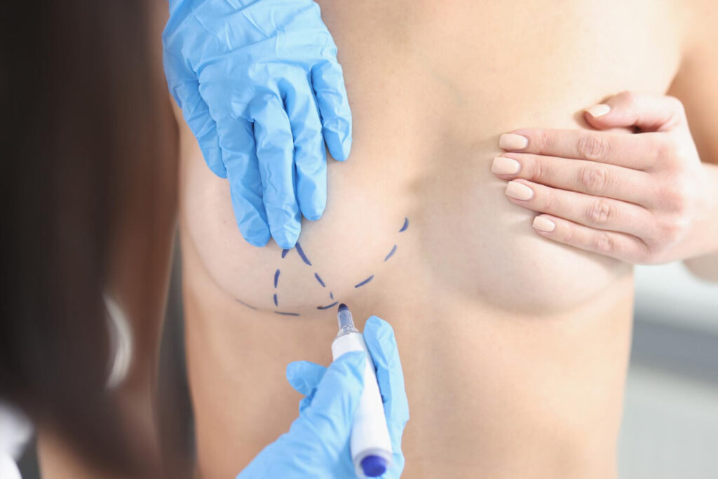 breast reduction surgeries leave scars