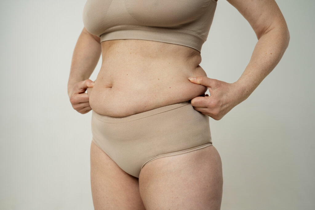 Tummy Tuck Candidate