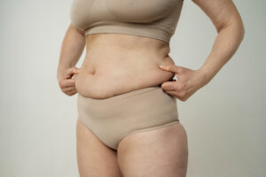 Tummy Tuck Candidate