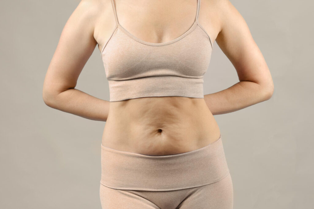 what is a tummy-tuck