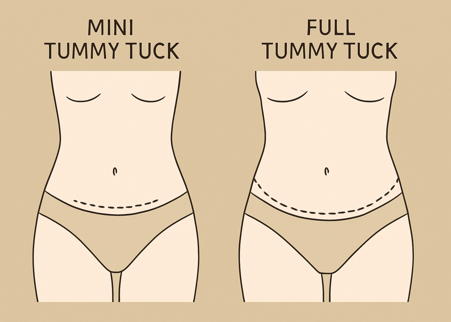 Mini Tummy Tuck vs Full Tummy Tuck